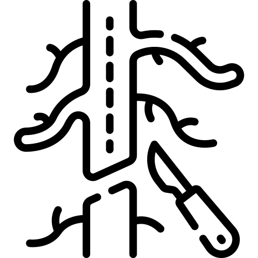 Illustration of vascular surgery showing branching blood vessels with a surgical scalpel making an incision.