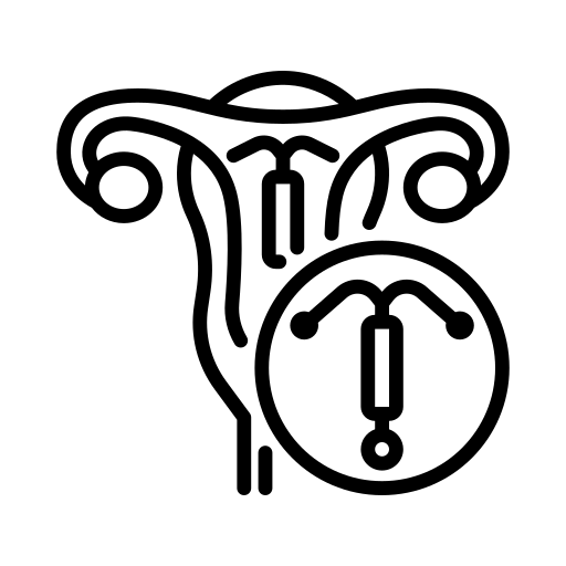 Illustration of a uterus with an intrauterine device (IUD) placed inside.